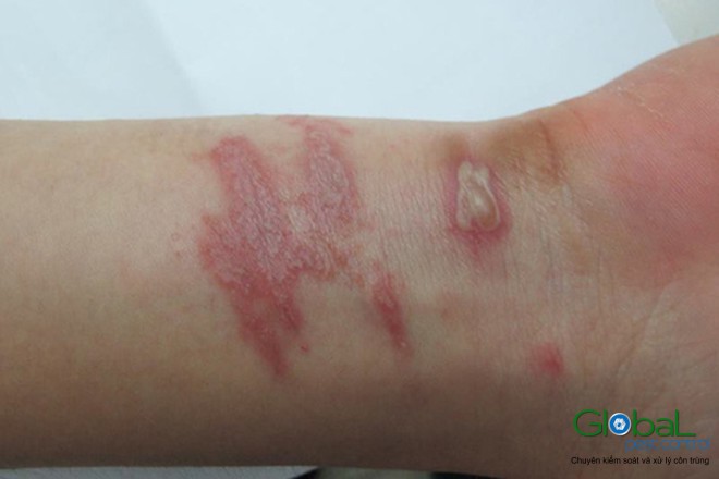 kien ba khoang 3 1631675321460342747280